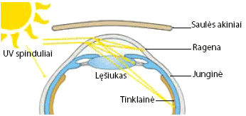 Akiniai nuo saulės ar kontaktiniai lęšiai be UV filtro