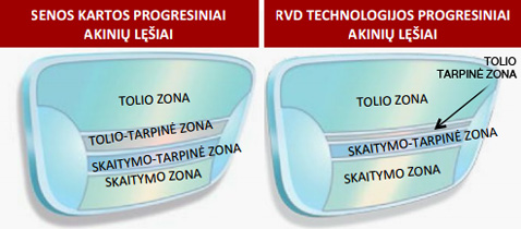 RVD – „Sumanus“ progresijos pasiskirstymas