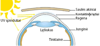 Akiniai nuo saulės ar kontaktiniai lęšiai su UV filtru